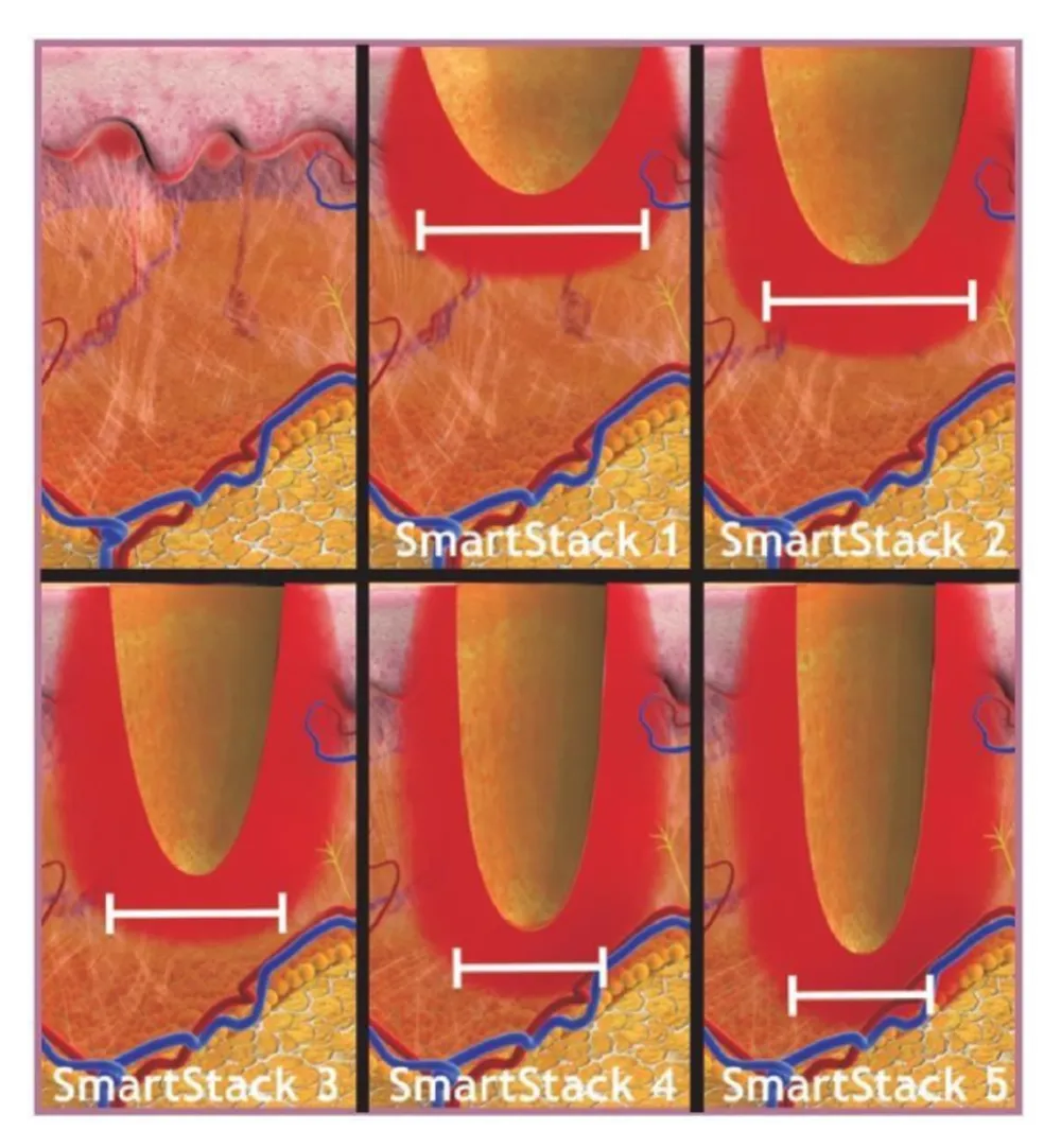Asclepion MultiPulse PRO ➜ Профессиональный CO2 лазер в Украине | Alfaspa изображение 52